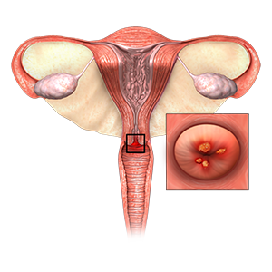 Cervical Smear/Pap Smear